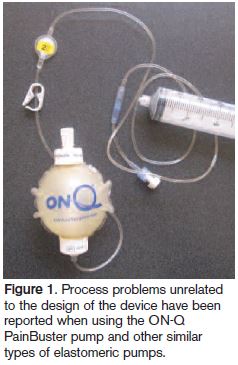 ON-Q painbuster pump