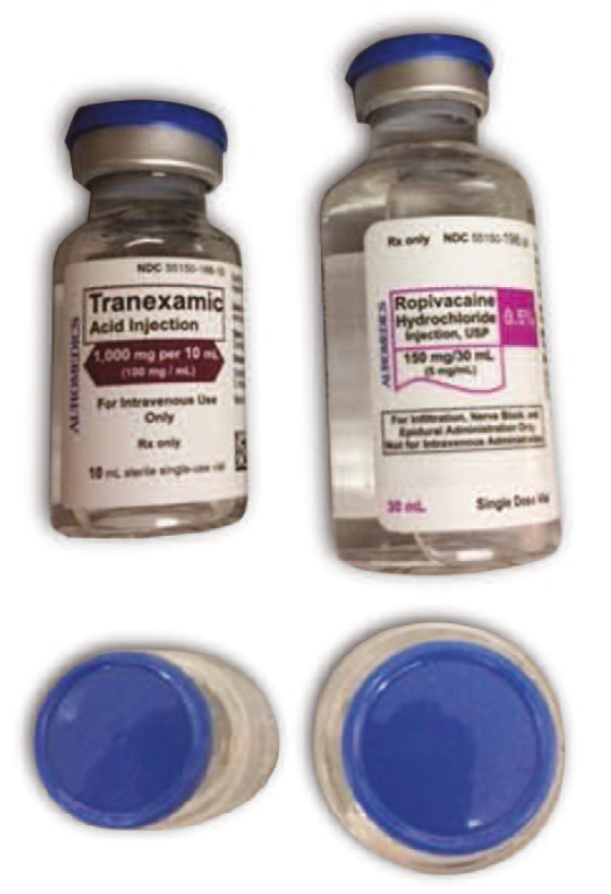 Figure 1. While label colors and vial sizes are different, the caps on ropivacaine and tranexamic acid vials (top), each from AuroMedics, are both blue and could lead staff to select a vial based on cap color, without reading the label, especially if the vials are stored upright with only the caps showing (bottom), not the labels. 