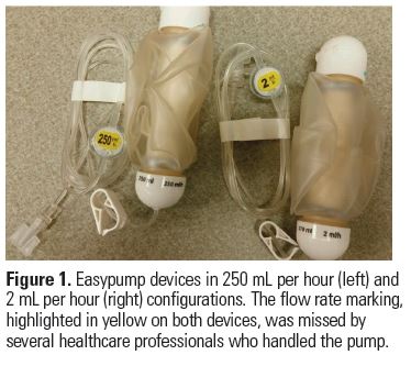 Chemo pump: Definition and how they work